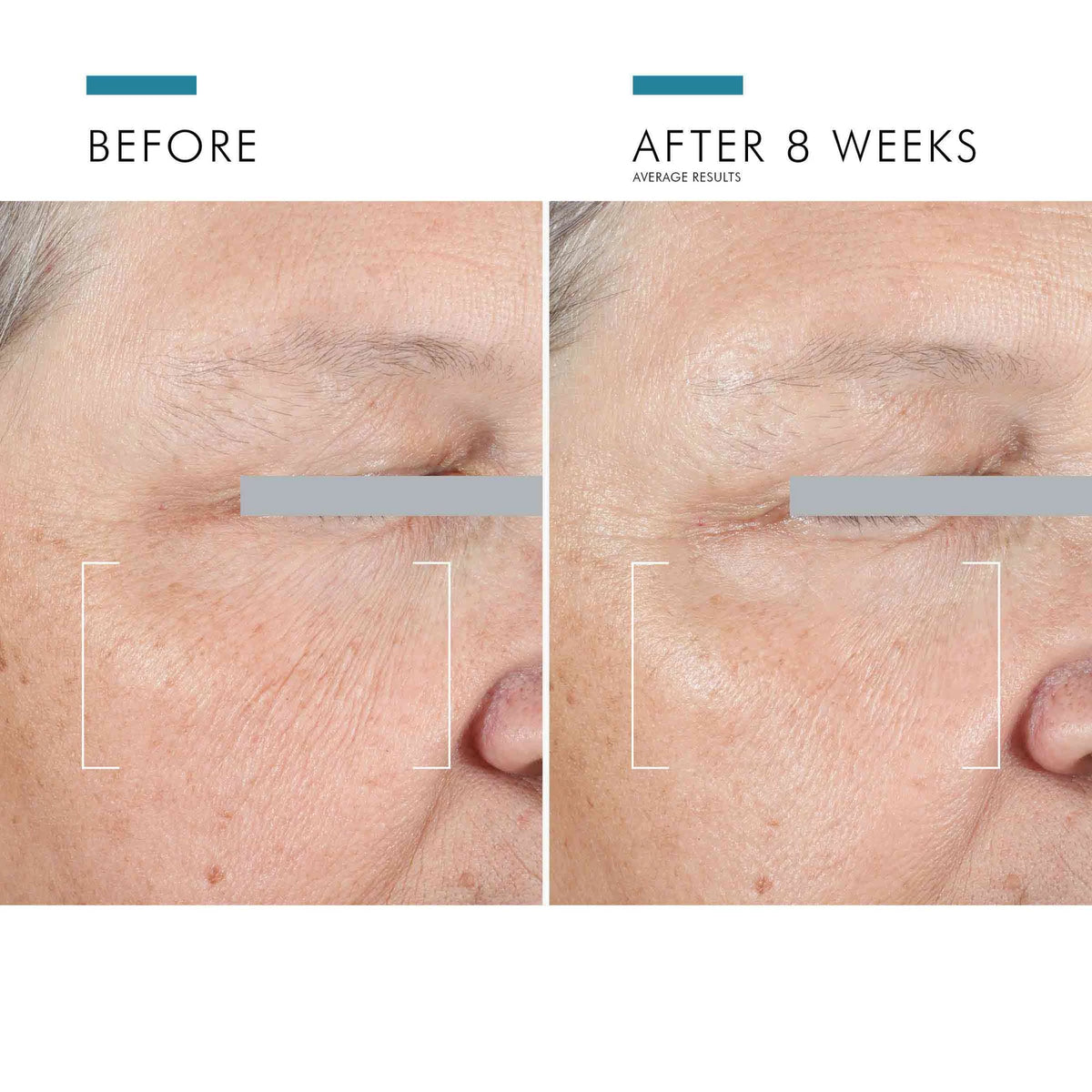 A.G.E. Advanced Eye for Dark Circles