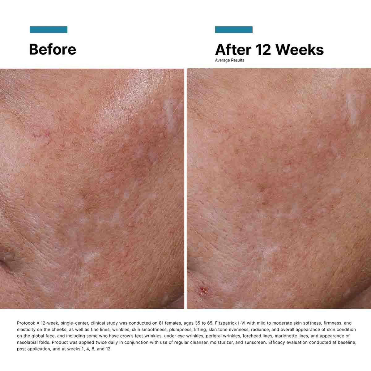 Hyaluronic Acid Intensifier Multi-Glycan