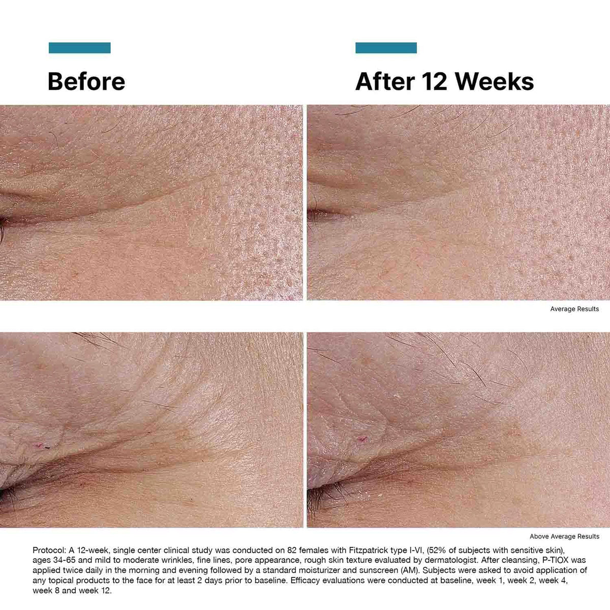P-TIOX Anti-Wrinkle Serum