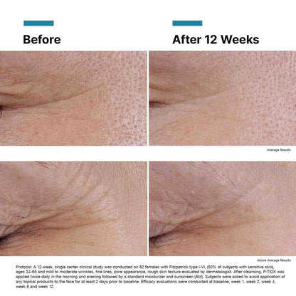 P-TIOX Anti-Wrinkle Serum